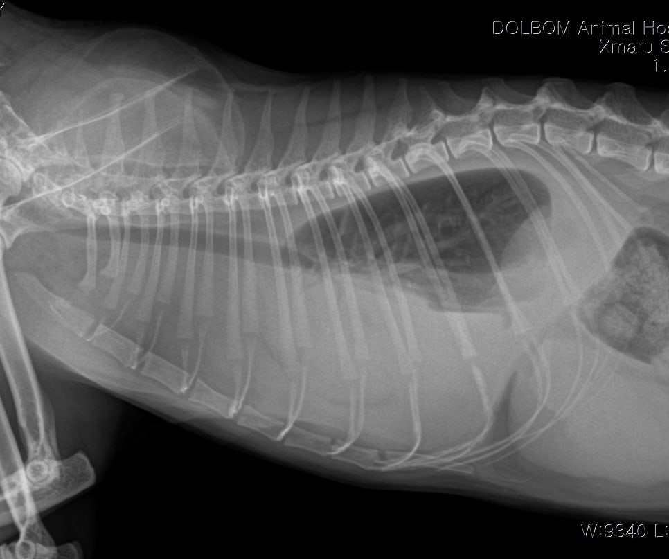 복부 lateral X-ray