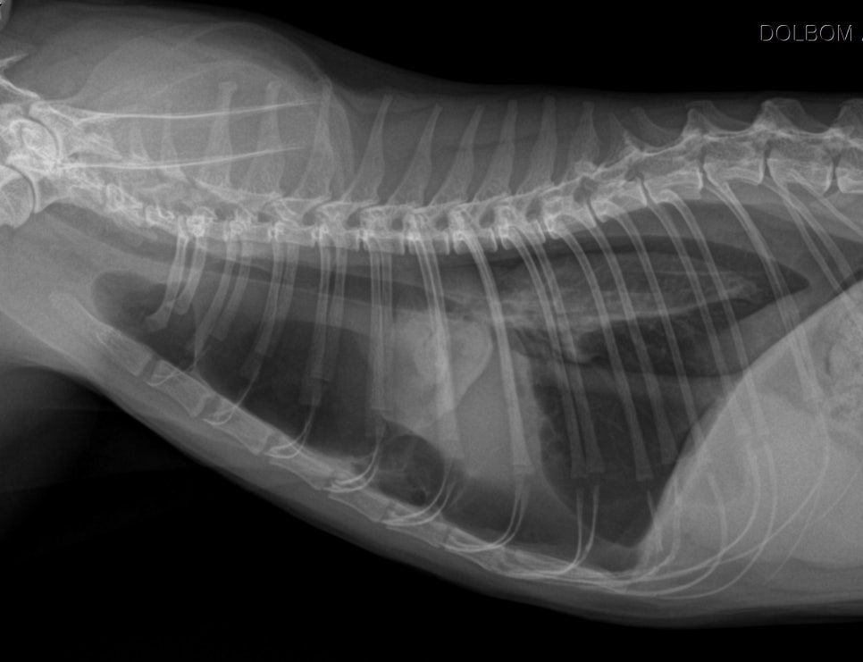 흉부 lateral X-ray
