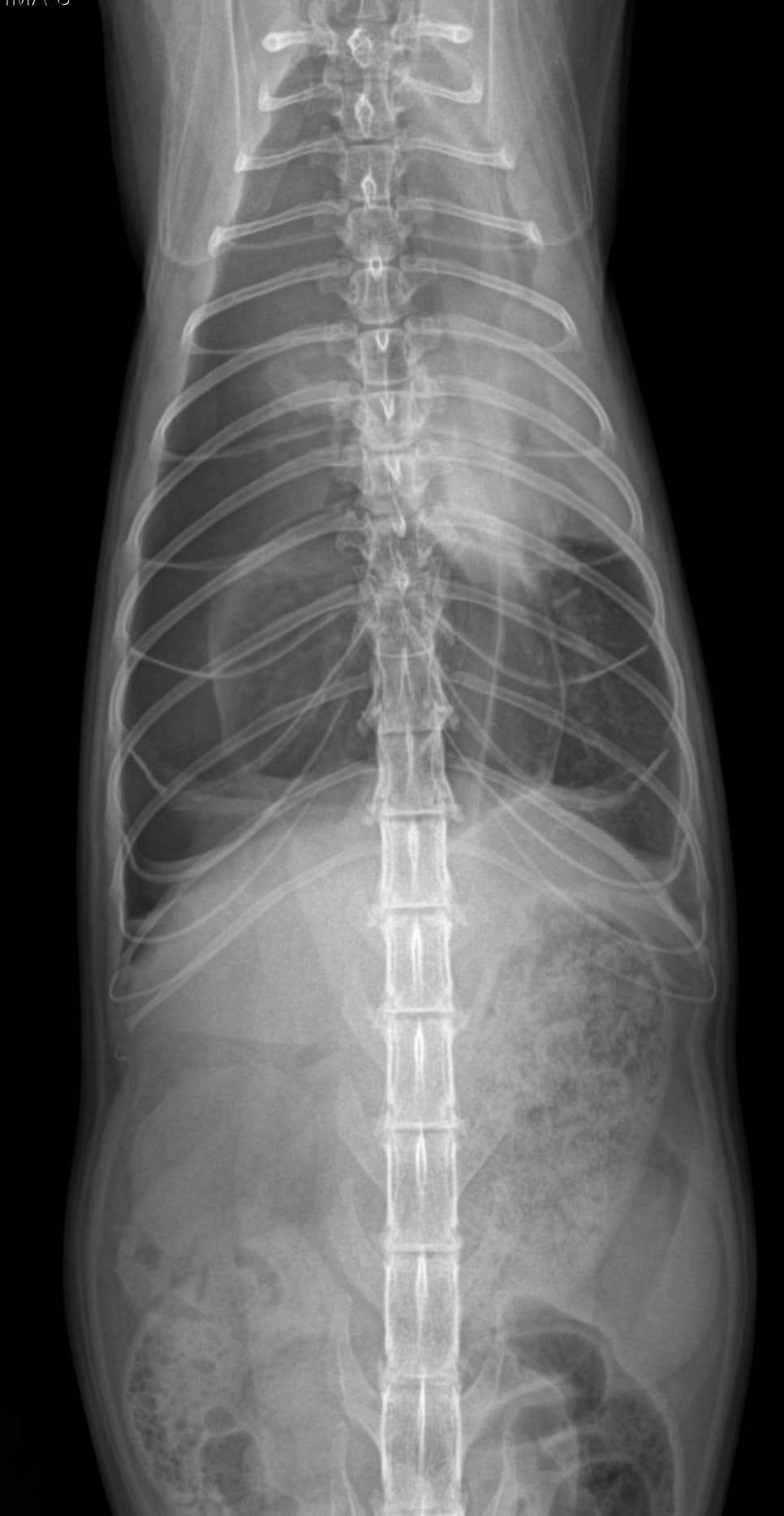 복부 VD X-ray
