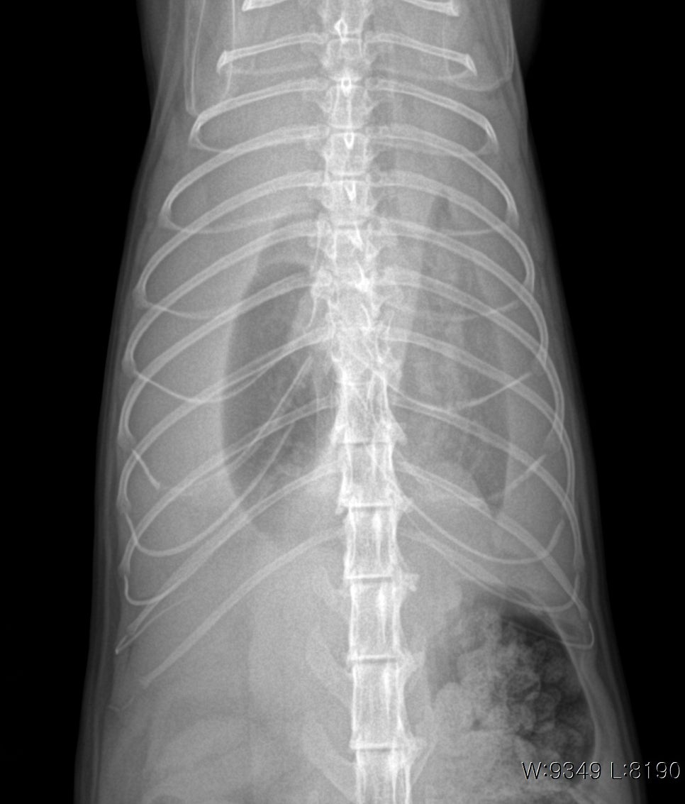 흉부 VD X-ray