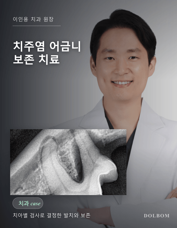 강아지 치주염, 치아 절제술과 신경치료로 어금니 일부를 보존한 사례-thumbnail