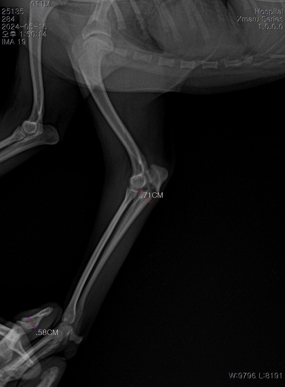 좌측 lateral X-ray with measurements