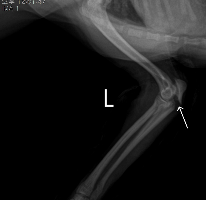 좌측 팔꿈치 lateral X-ray