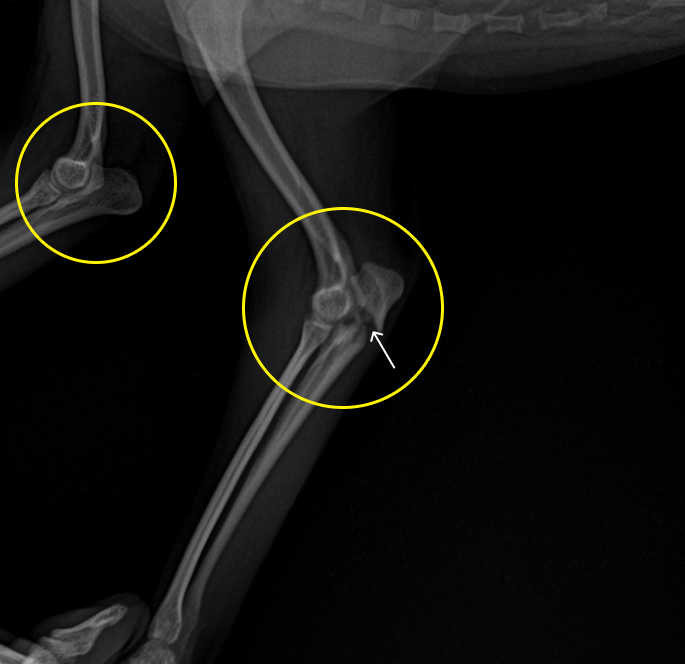 양측 팔꿈치 X-ray