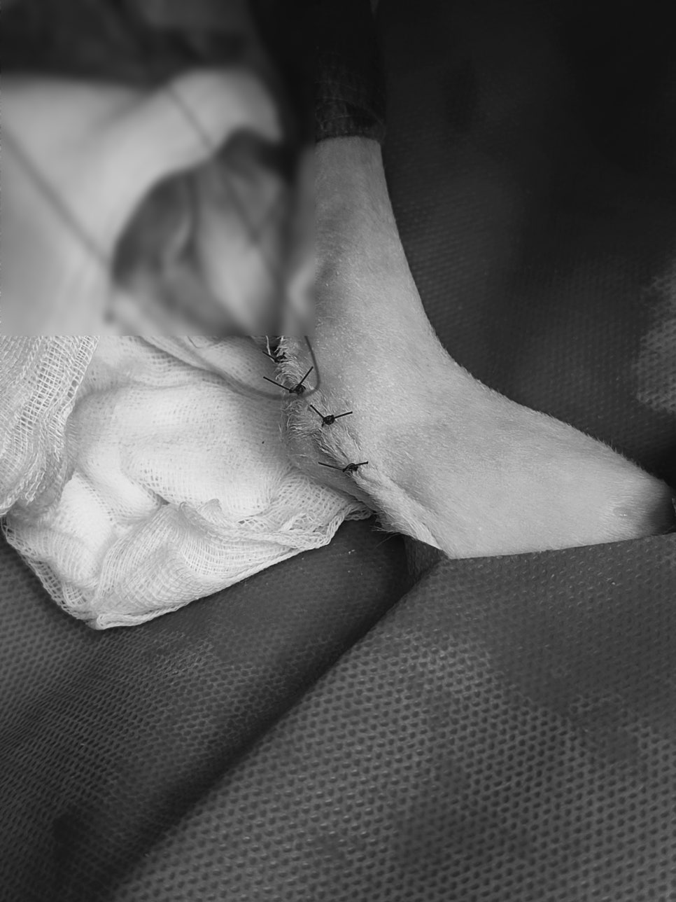수술 후 봉합 상태
