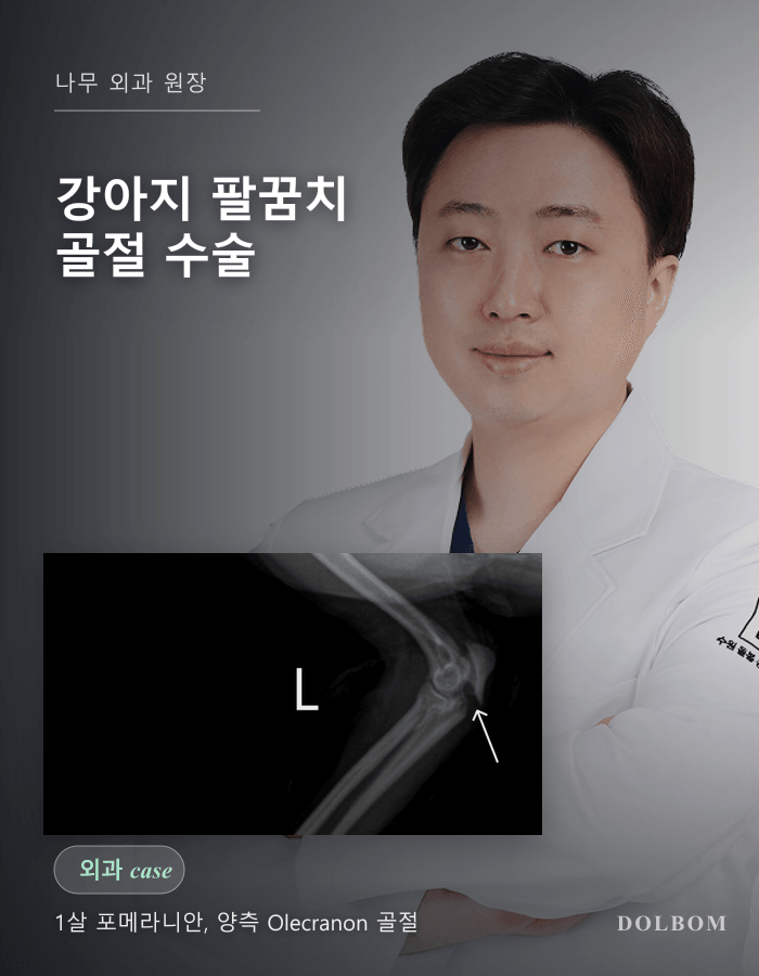 강아지 양측 팔꿈치 골절(Olecranon Fracture) 수술 케이스 (K-wire + Tension Band)-thumbnail