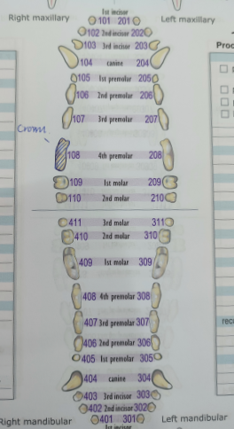 108번 치아에 크라운 표시가 있는 치과 차트