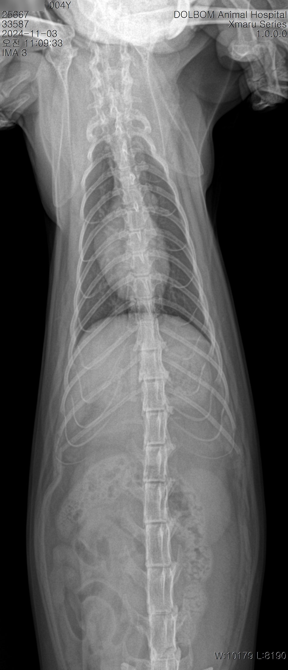 흉부 X-ray VD