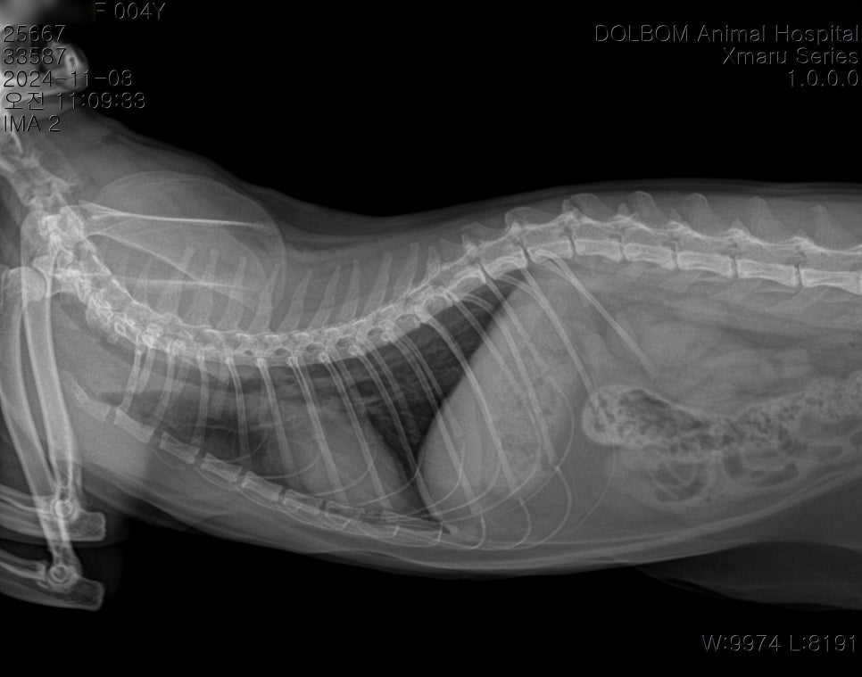 흉부 X-ray lateral