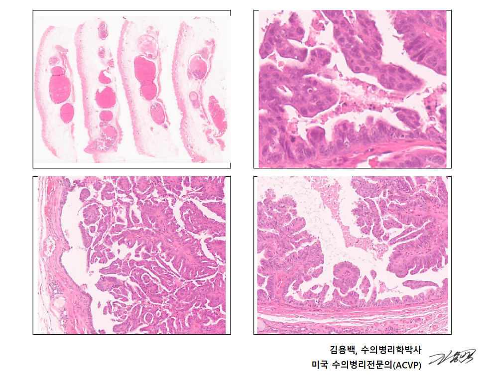 유선 종양 조직의 현미경 사진