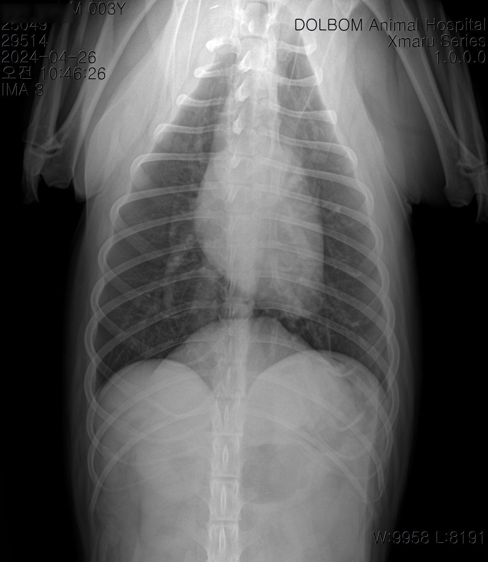 흉부 X-ray DV