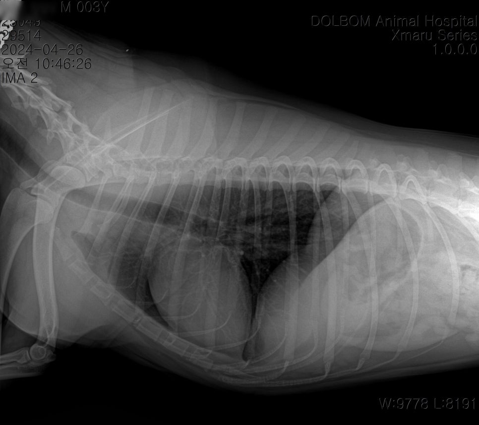 흉부 X-ray 측면