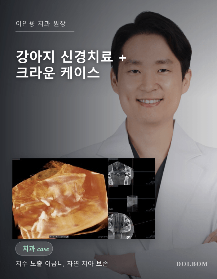 강아지 신경치료 + 크라운 장착 — 치수 노출 어금니 자연 치아 보존-thumbnail