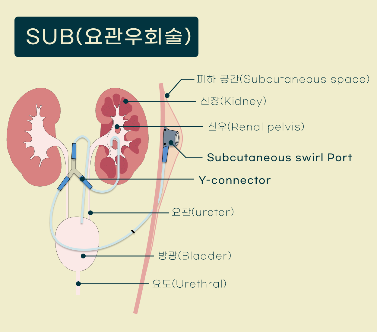 SUB.png