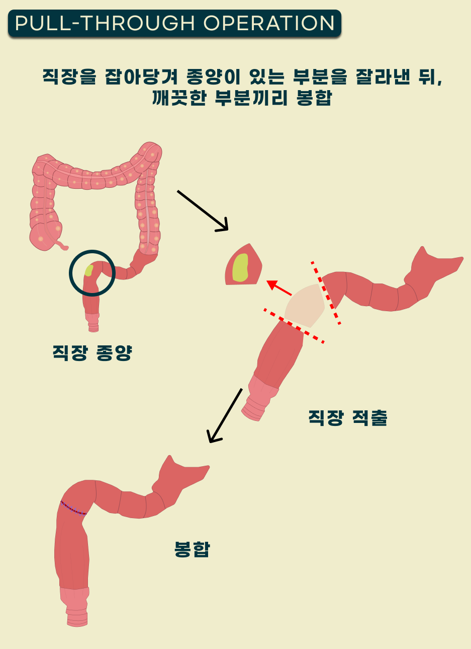 Pull-Through Operation 다이어그램