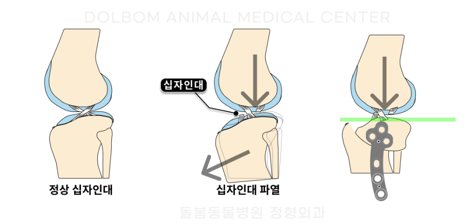 경골 고평부를 회전하고 금속판으로 고정하는 TPLO 원리 그림