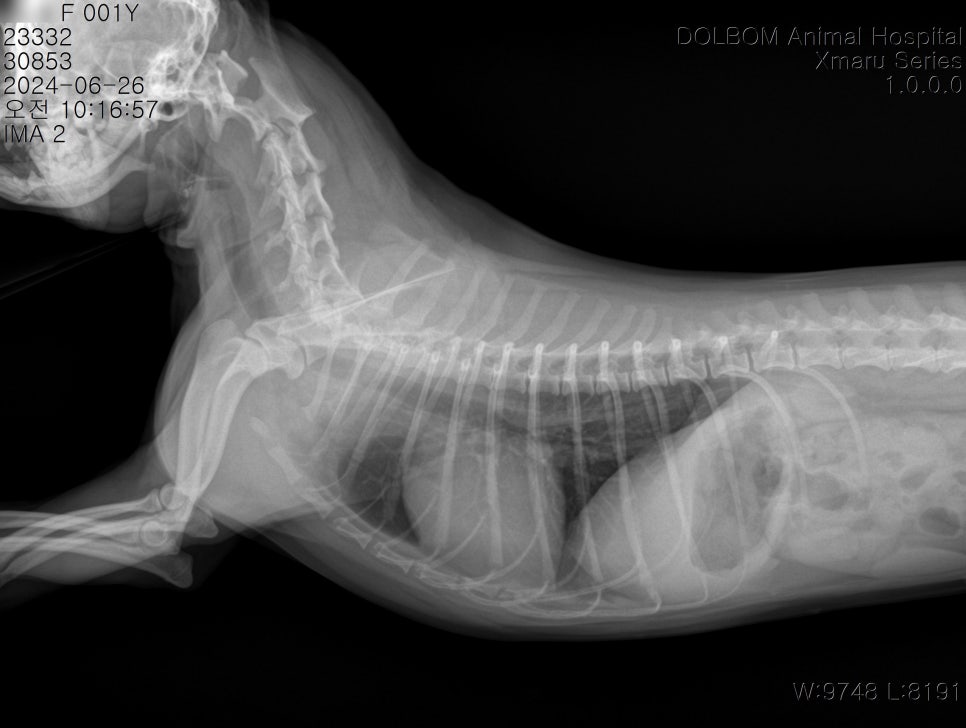 흉부 X-ray 측면