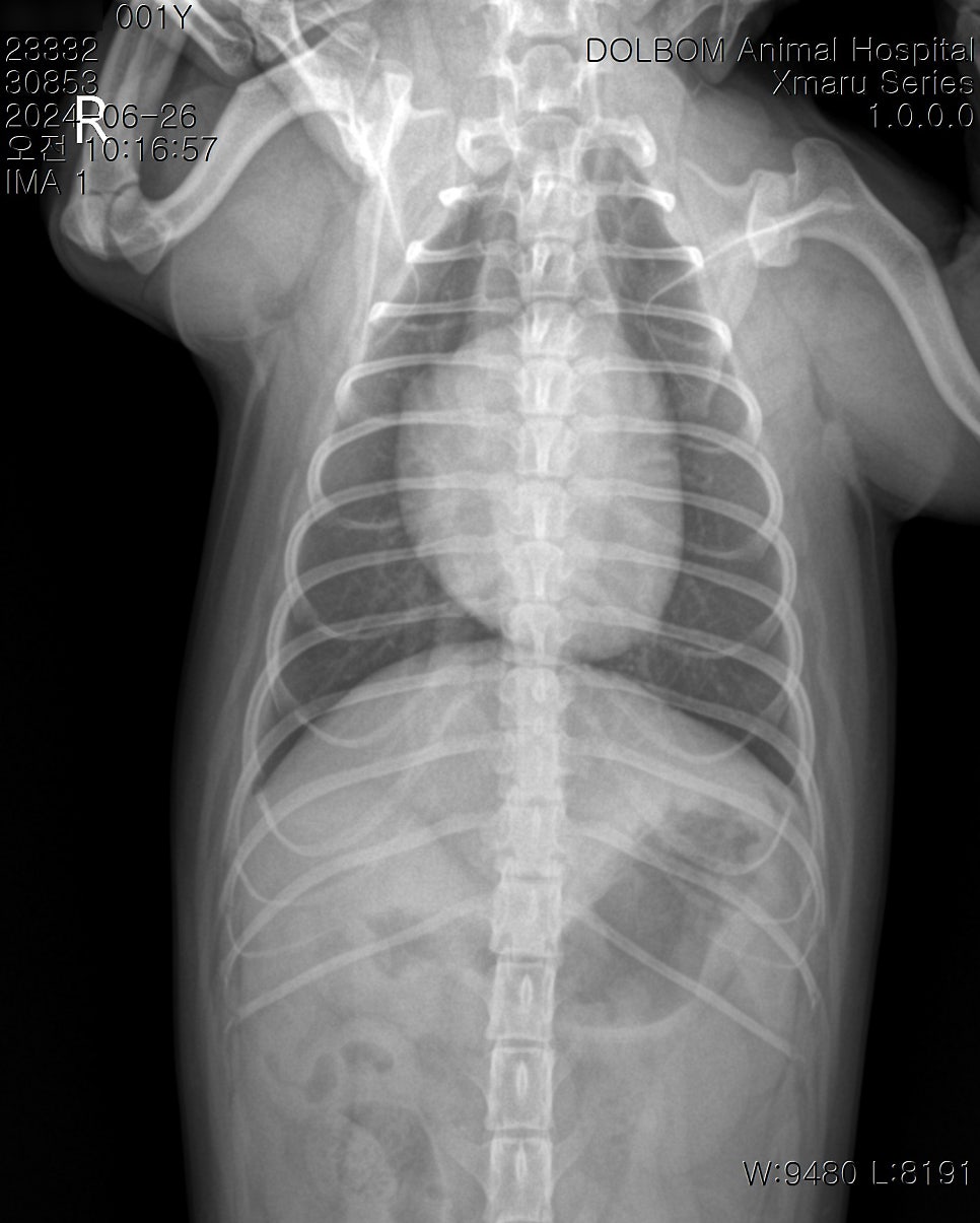 흉부 X-ray VD