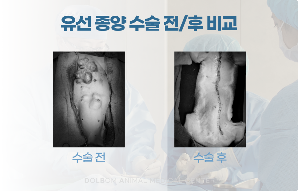 동일 환자의 수술 전 복부 종괴와 수술 후 봉합선 비교