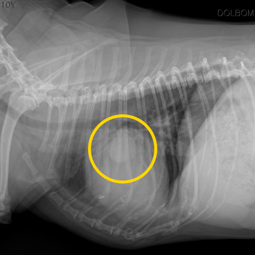 흉부 X-ray 우측면