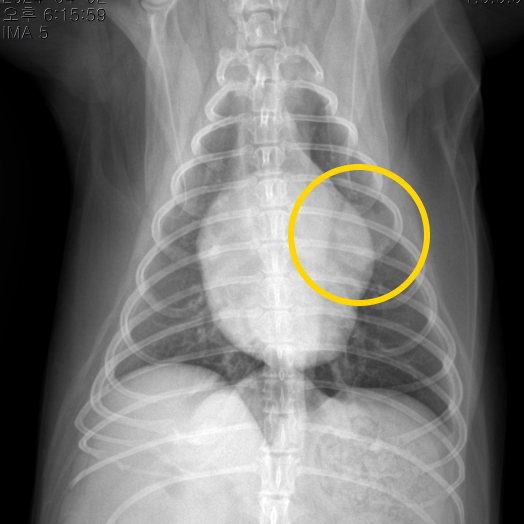 흉부 X-ray 다른 각도