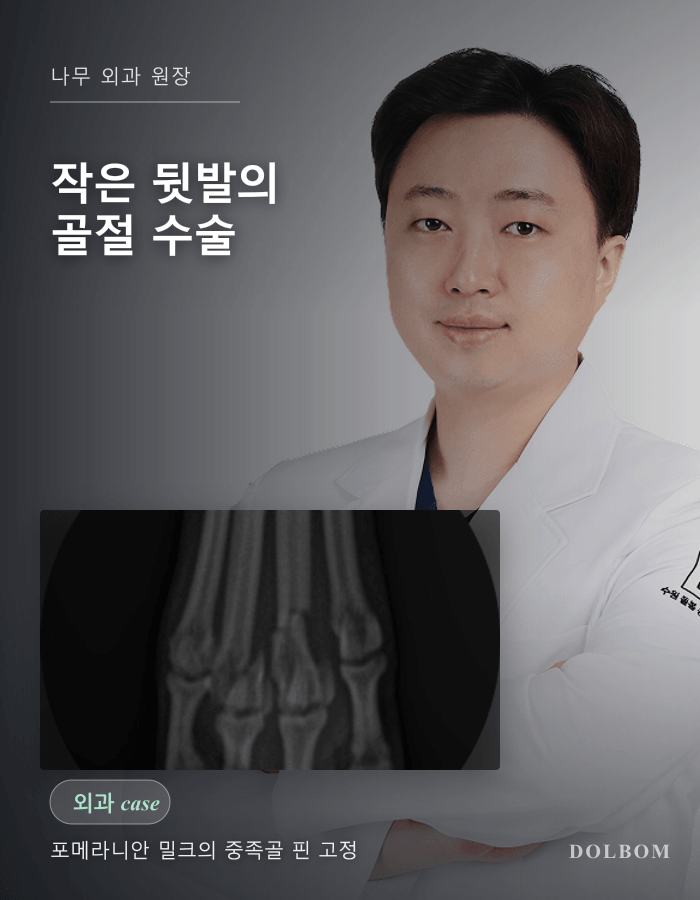 1살 포메라니안의 세 번째 중족골 골절, 핀 고정 수술-thumbnail
