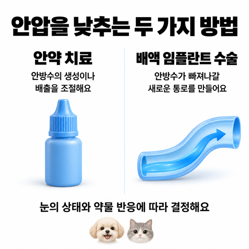 안약 치료와 배액 임플란트 수술의 역할을 비교한 설명 그림